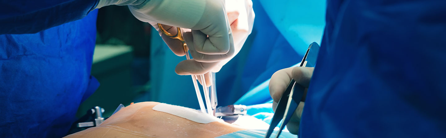 Open-Heart-Surgery_-Risks,-Procedure,-and-Preparation